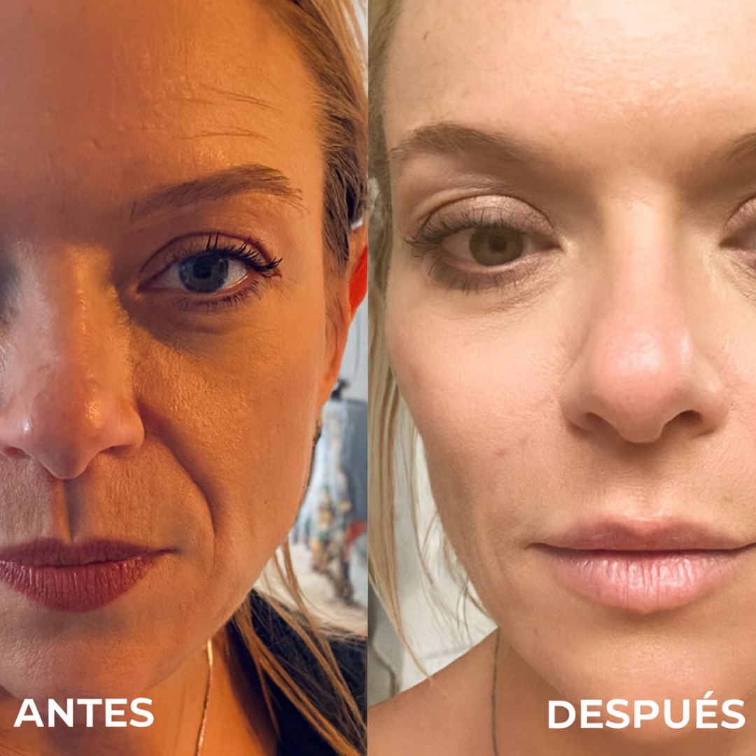 Crema Facial Anti-Edad con extracto de sangre de dragón (1+1 GRATIS)
